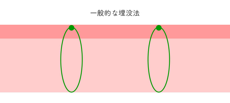 埋没法