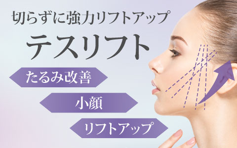 テスリフト