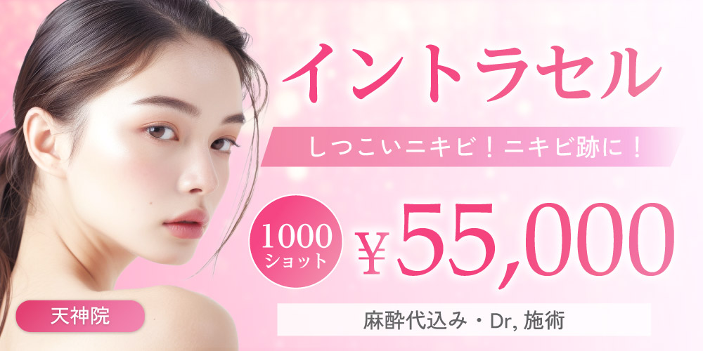 しつこいニキビ！ニキビ跡に！イントラセル1000ショット（麻酔代込み・Dr,施術）｜55,000円