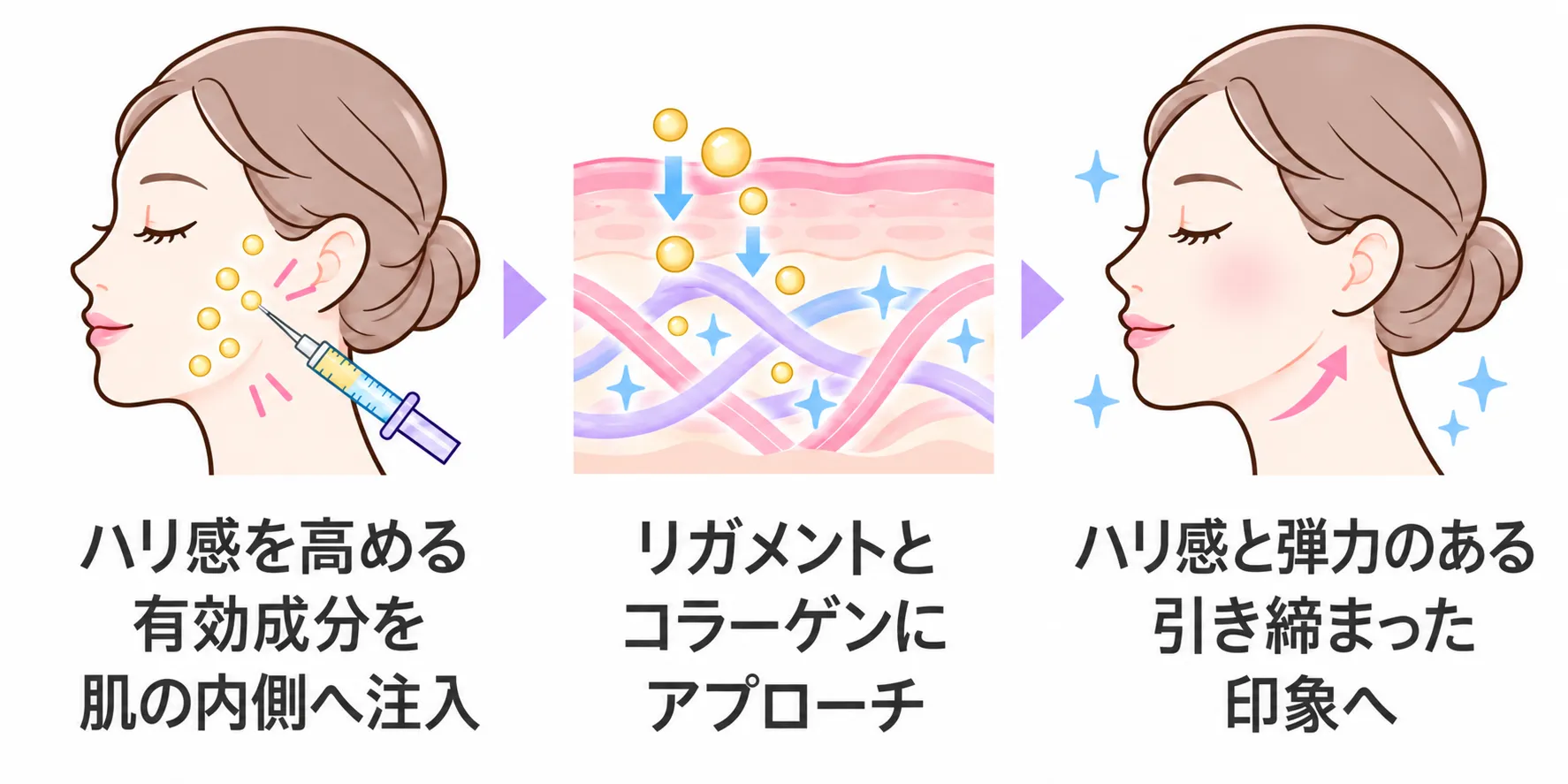 ジャルプロスーパーハイドロの施術のしくみ