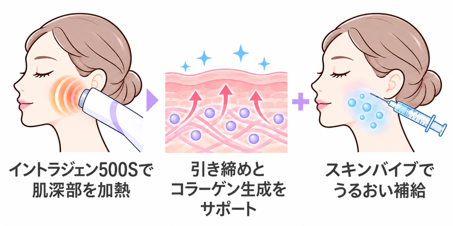 スキンバイブ×イントラジェンの施術のしくみ