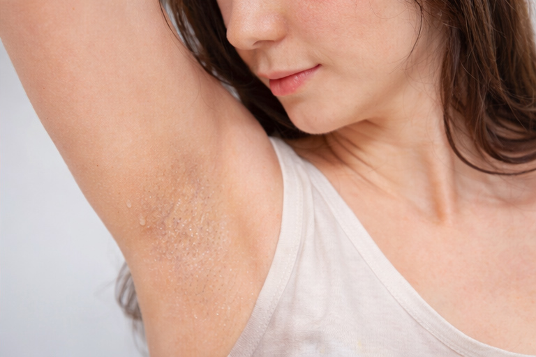 多汗症の症例イメージ