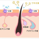 脇汗の原因は？大量の汗やニオイの悩みを解消する方法