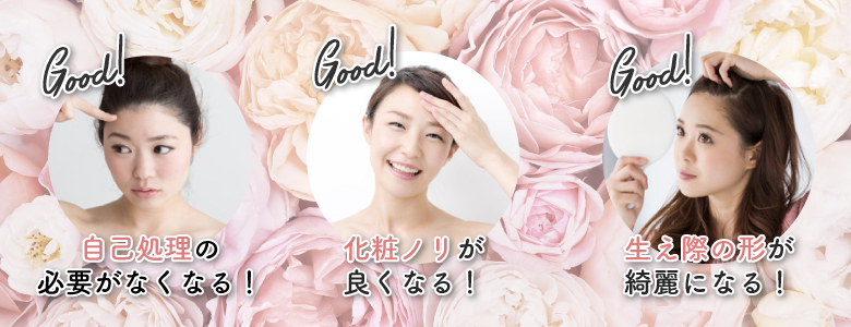 おでこ脱毛の効果・メリットとは?
