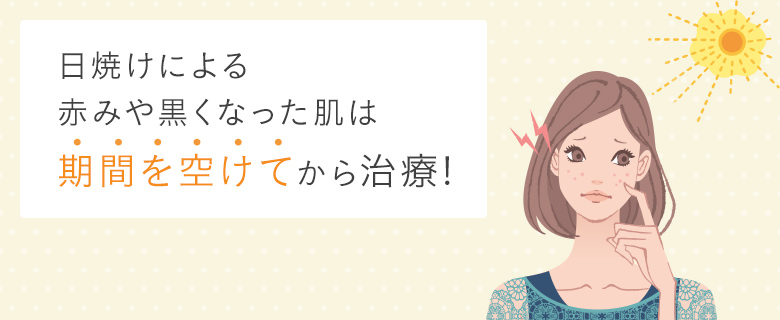 日焼け（日光皮膚炎）