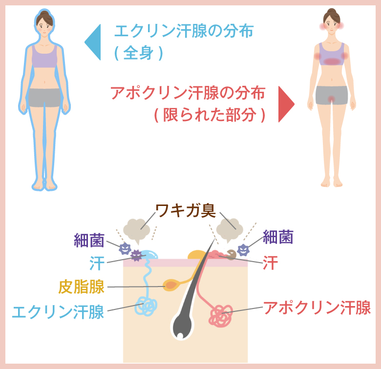 体の汗腺分布とわきがの原因