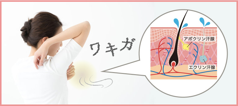 わきがとは?ニオイの原因は何?