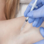 京橋 ボトックス ワキガ 比較