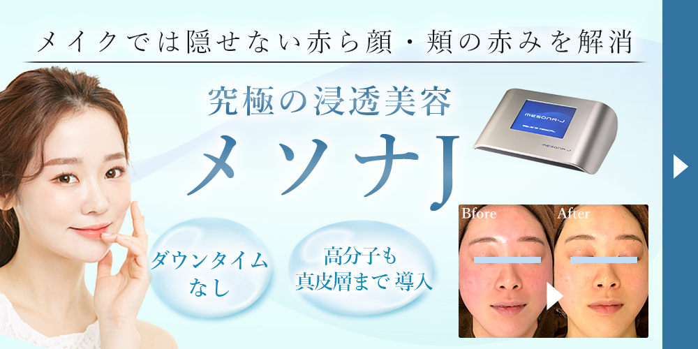 赤ら顔 メソナJ