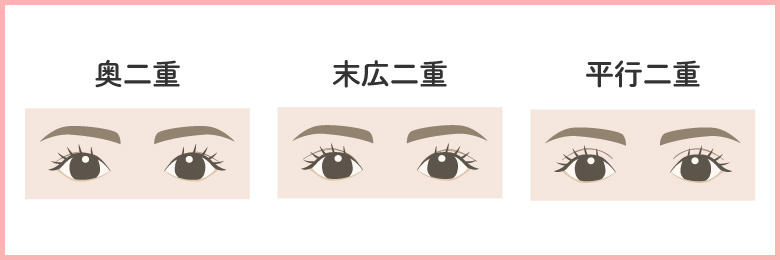 【二重の種類】アイメイクのポイントも！