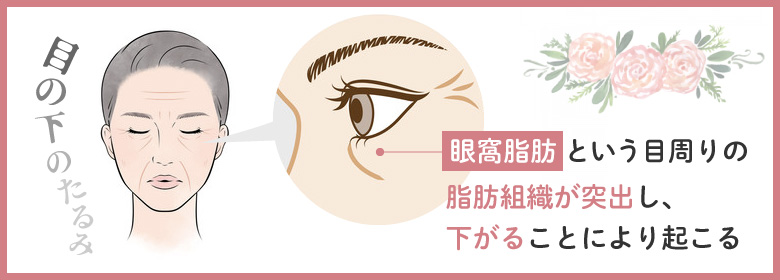 目の下にあるひどい「たるみ」とは？