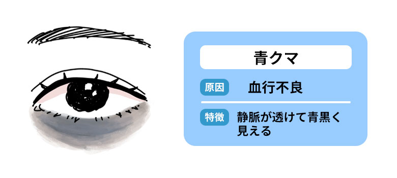 青クマの特徴と原因
