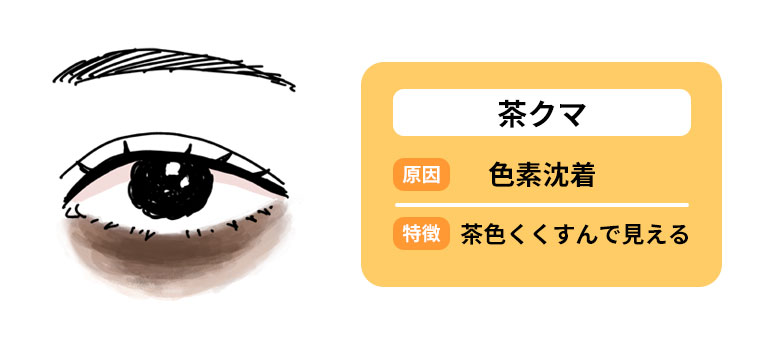 茶クマの特徴と原因