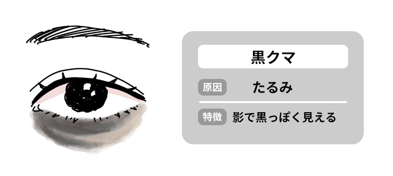 黒クマの特徴と原因