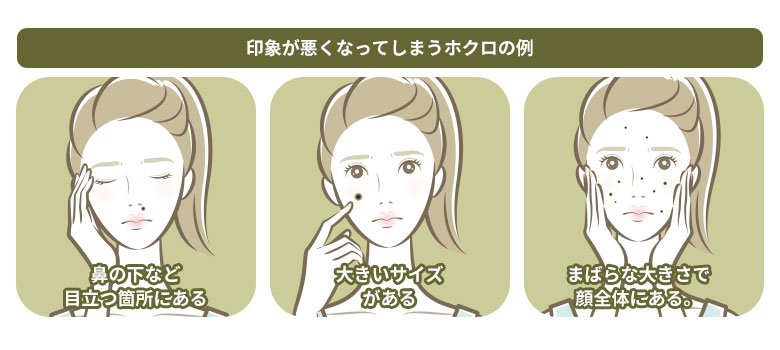 良いホクロとダメなホクロ