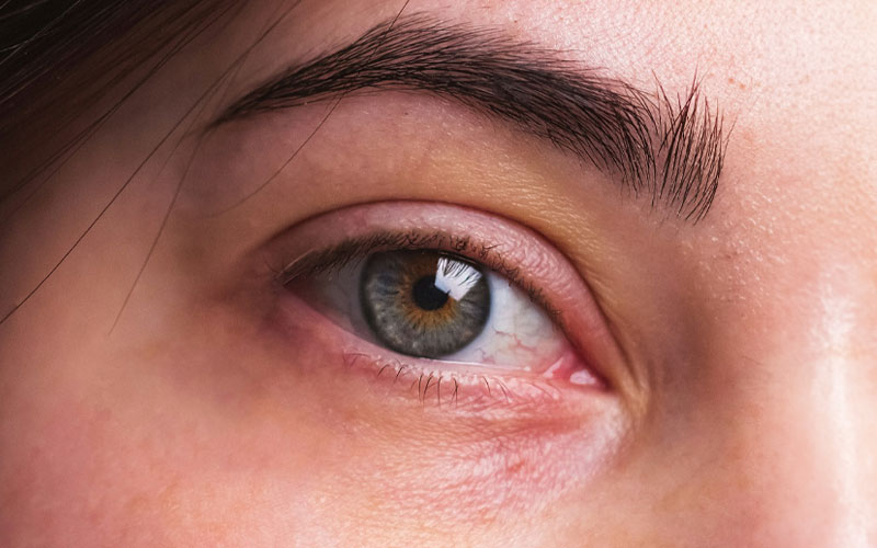 ハムラ法のイメージ