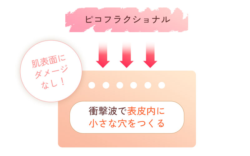 ピコフラクショナル