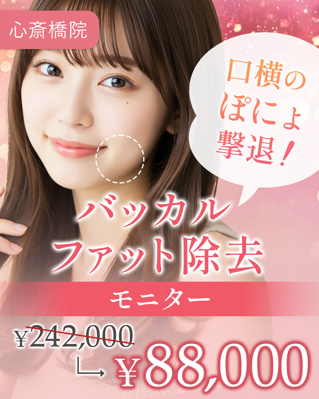 口元すっきりケア