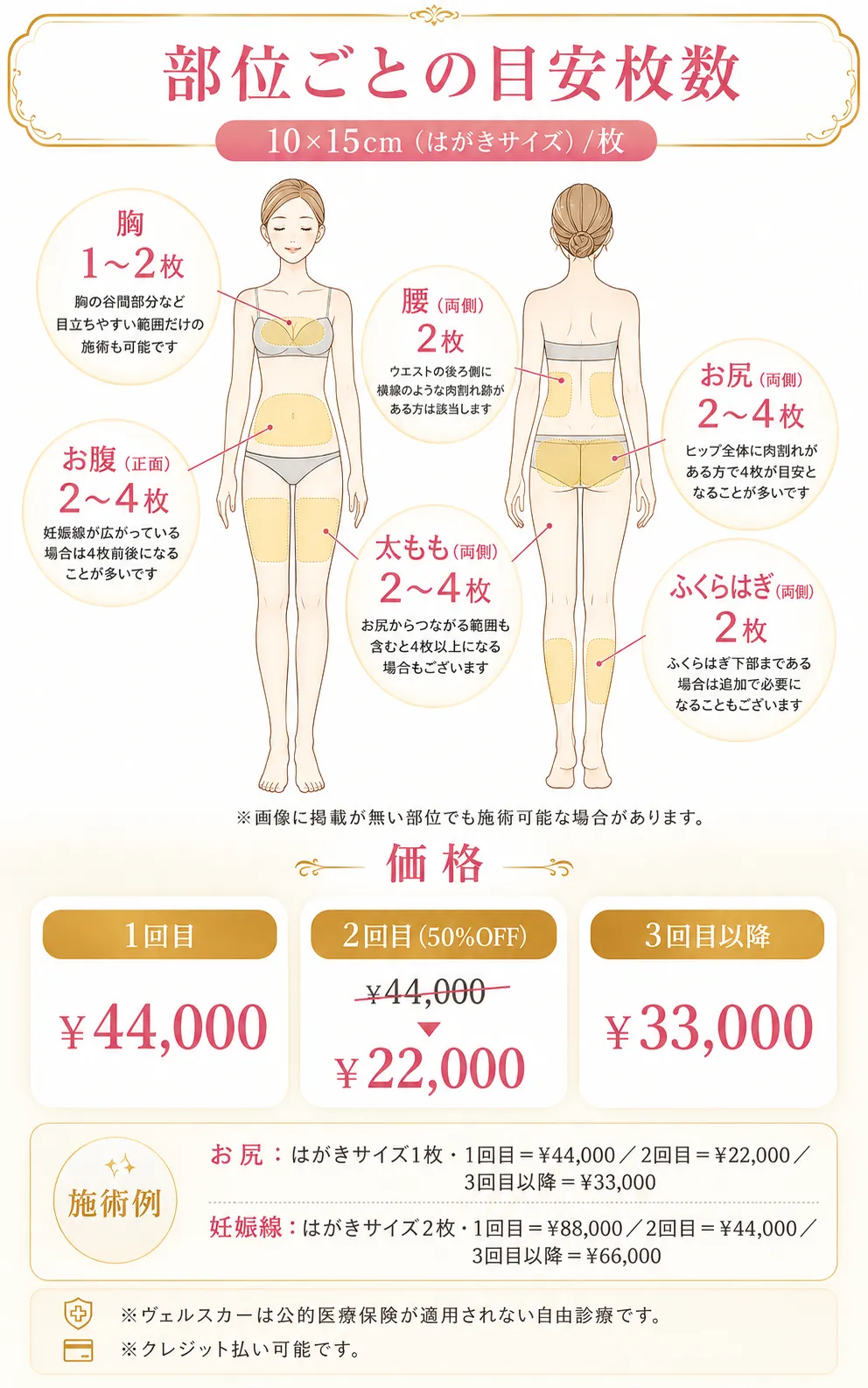 ヴェルスカー 価格